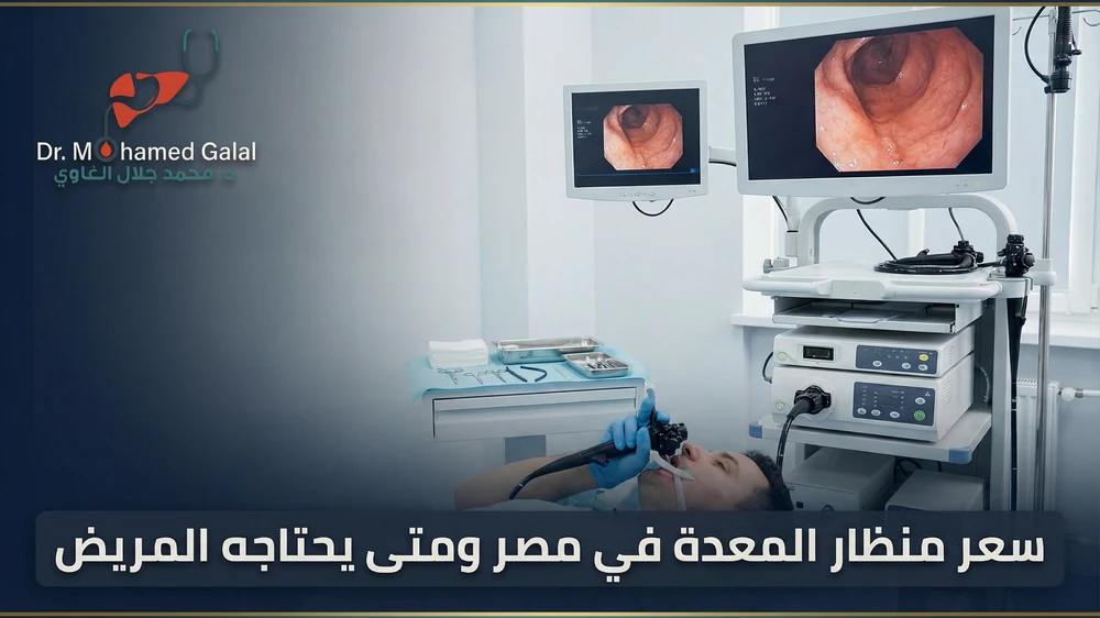 سعر منظار المعدة في مصر ومتى يحتاجه المريض