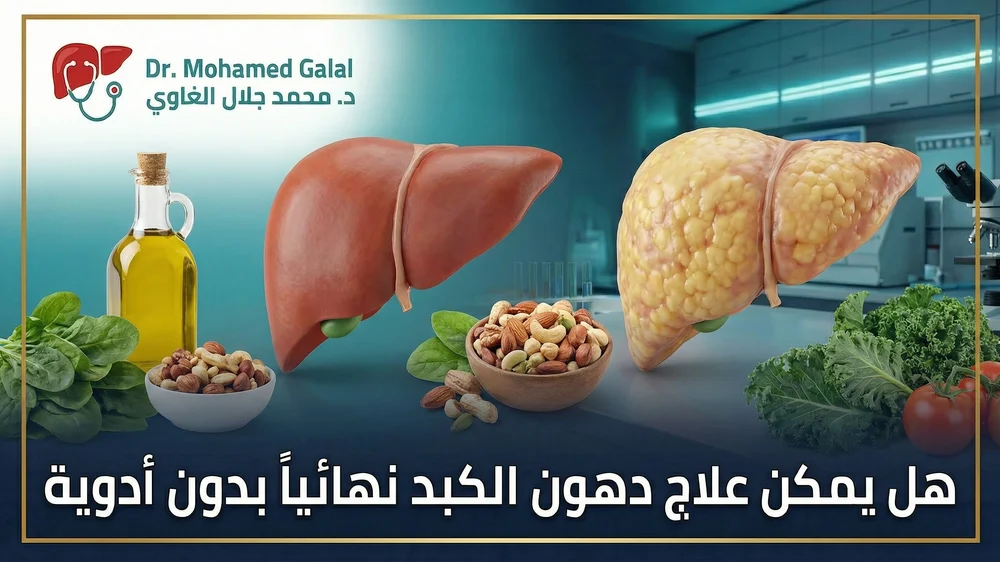 هل يمكن علاج دهون الكبد نهائياً بدون أدوية