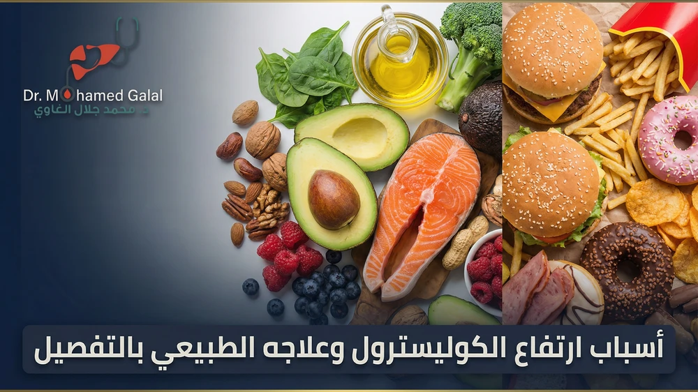 أسباب ارتفاع الكوليسترول وعلاجه الطبيعي بالتفصيل