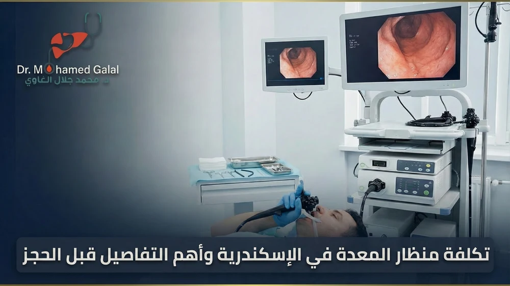 تكلفة منظار المعدة في الإسكندرية وأهم التفاصيل قبل الحجز