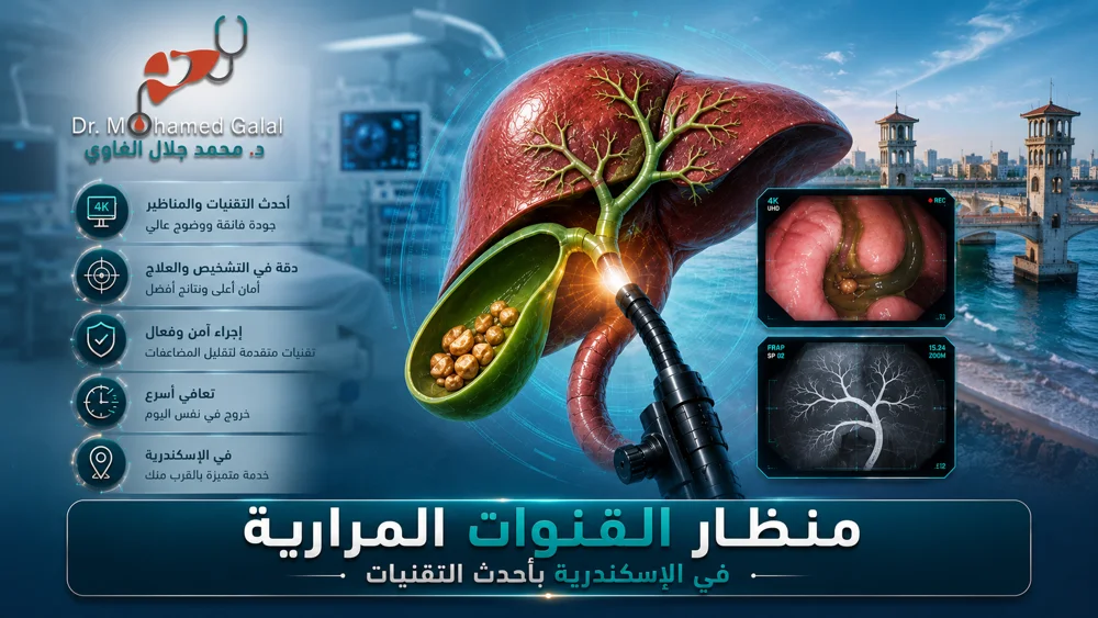 منظار القنوات المرارية في الإسكندرية بأحدث التقنيات
