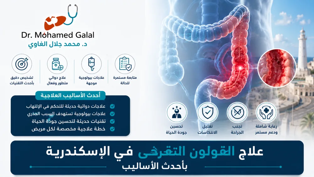 علاج القولون التقرحي في الإسكندرية بأحدث الأساليب